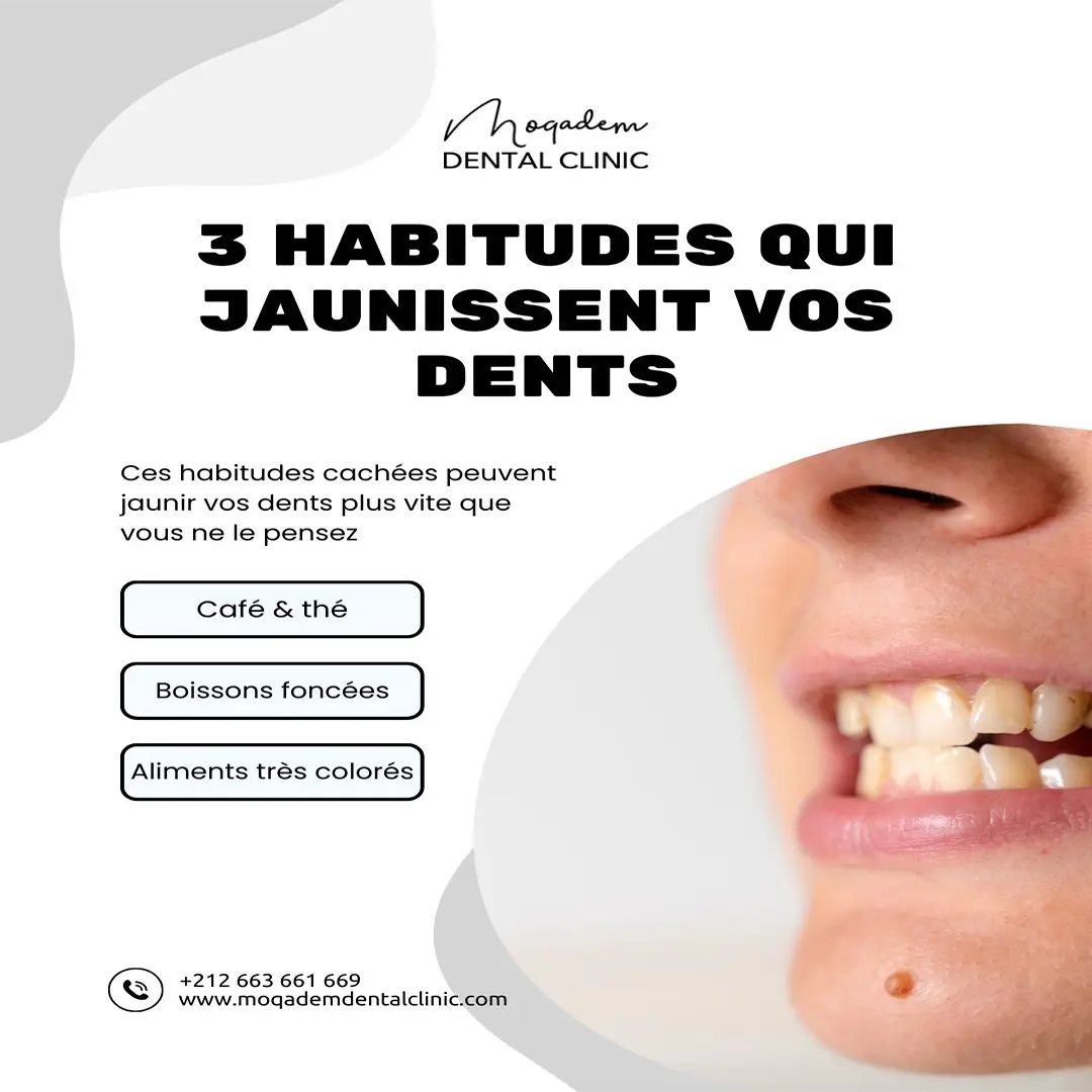 Publication Instagram Laboratoire Amerchich