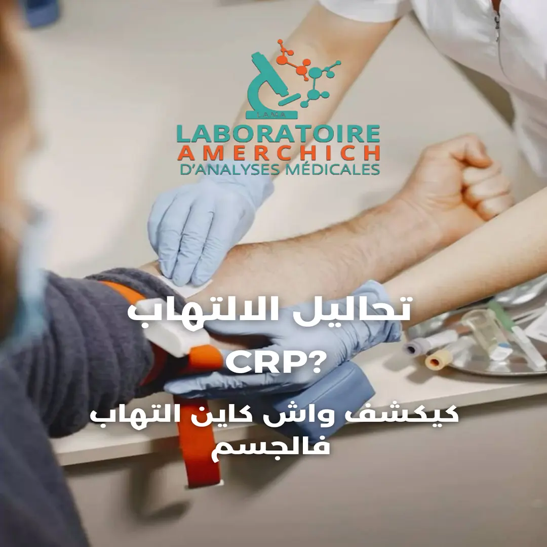 Publication Instagram Laboratoire Amerchich