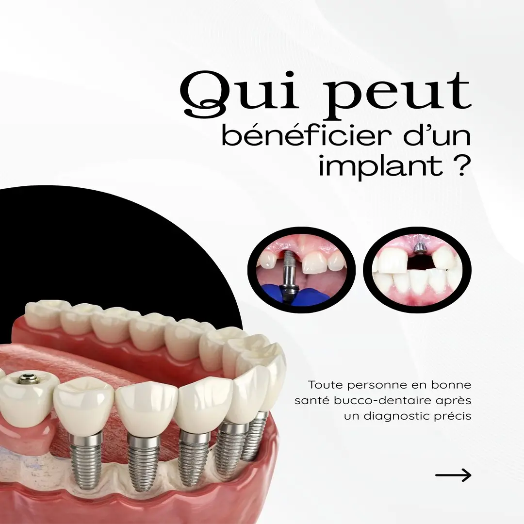 Publication Instagram Laboratoire Amerchich