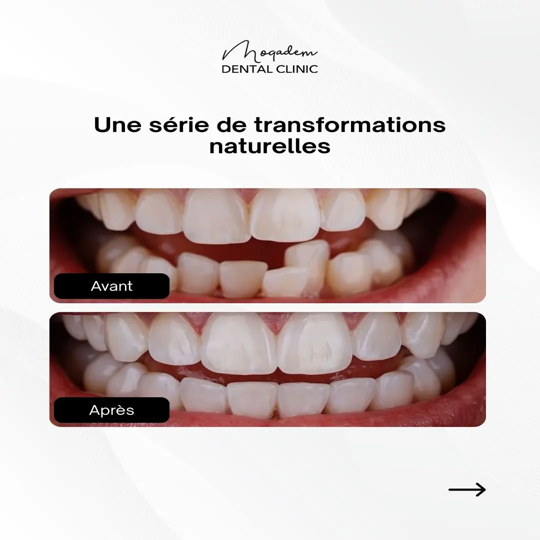 Publication Instagram Laboratoire Amerchich